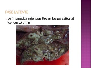 Asintomatica mientras llegan los parasitos al 
conducto biliar 
 