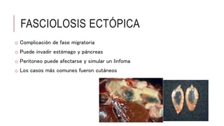 FASCIOLOSIS ECTÓPICA
o Complicación de fase migratoria
o Puede invadir estómago y páncreas
o Peritoneo puede afectarse y simular un linfoma
o Los casos más comunes fueron cutáneos
 