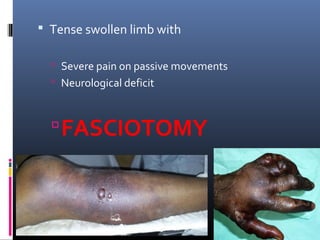  Tense swollen limb with
 Severe pain on passive movements
 Neurological deficit
FASCIOTOMY
 