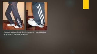Corregir acortamiento de tríceps sural + debilidad de
musculatura intrínseca del pie
 
