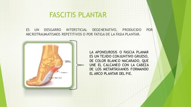 FASCITIS PLANTAR
ES UN DESGARRO INTERSTICIAL DEGENERATIVO, PRODUCIDO POR
MICROTRAUMATISMOS REPETITIVOS O POR FATIGA DE LA ...