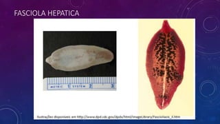 FASCIOLA HEPATICA
 