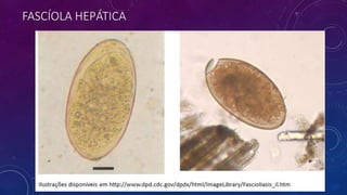 FASCÍOLA HEPÁTICA
 