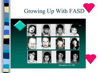 Growing Up With FASD
 
