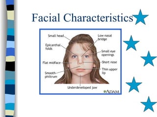 Facial Characteristics
 