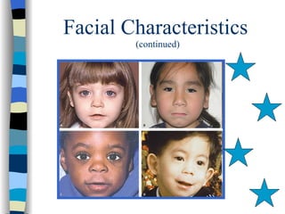 Facial Characteristics
        (continued)
 