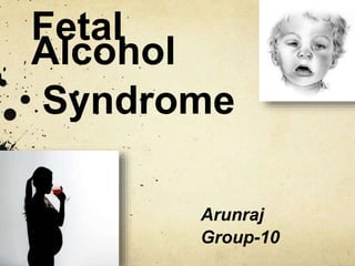 Fetal
Alcohol
Syndrome
Arunraj
Group-10
 