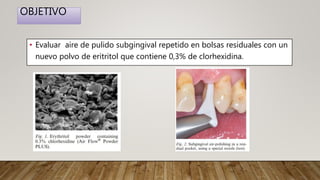 OBJETIVO
• Evaluar aire de pulido subgingival repetido en bolsas residuales con un
nuevo polvo de eritritol que contiene 0,3% de clorhexidina.
 