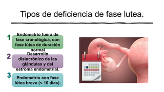 Tipos de deficiencia de fase lutea.
Endometrio fuera de
fase cronológica, con
fase lútea de duración
normal
Desarrollo
disincrónico de las
glándulas y del
estroma endometrial.
Endometrio con fase
lútea breve (< 10 días).
 