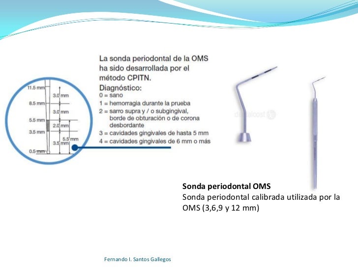 Fases de tratamiento periodontal