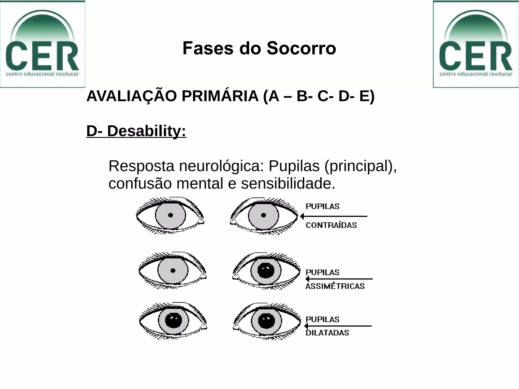 Fases do Socorro
AVALIAÇÃO PRIMÁRIA (A – B- C- D- E)
D- Desability:
Resposta neurológica: Pupilas (principal),
confusão mental e sensibilidade.
 