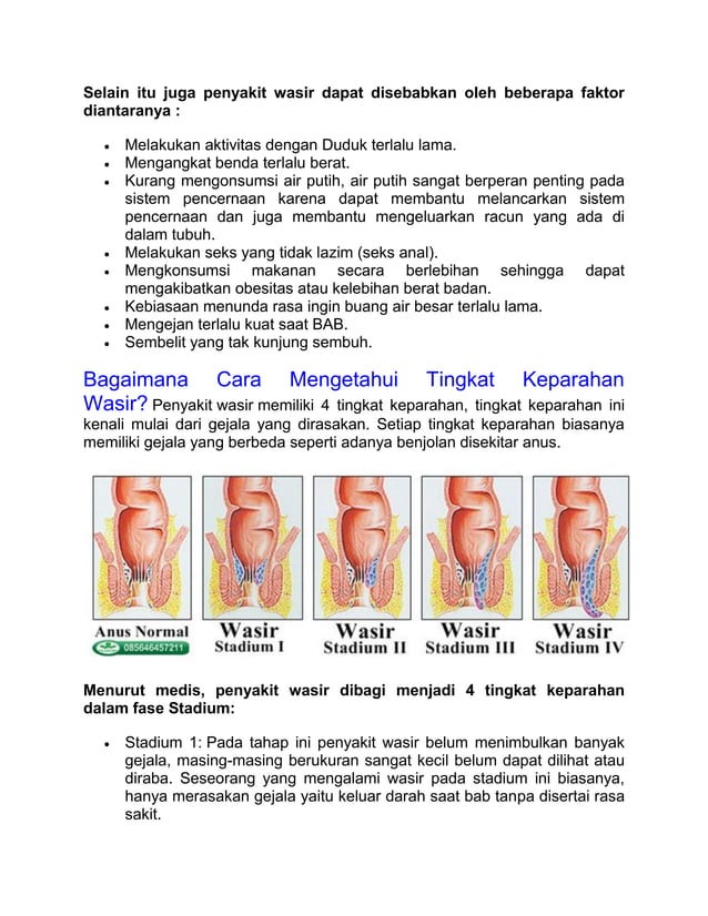 Contoh Gambar Wasir Stadium 4