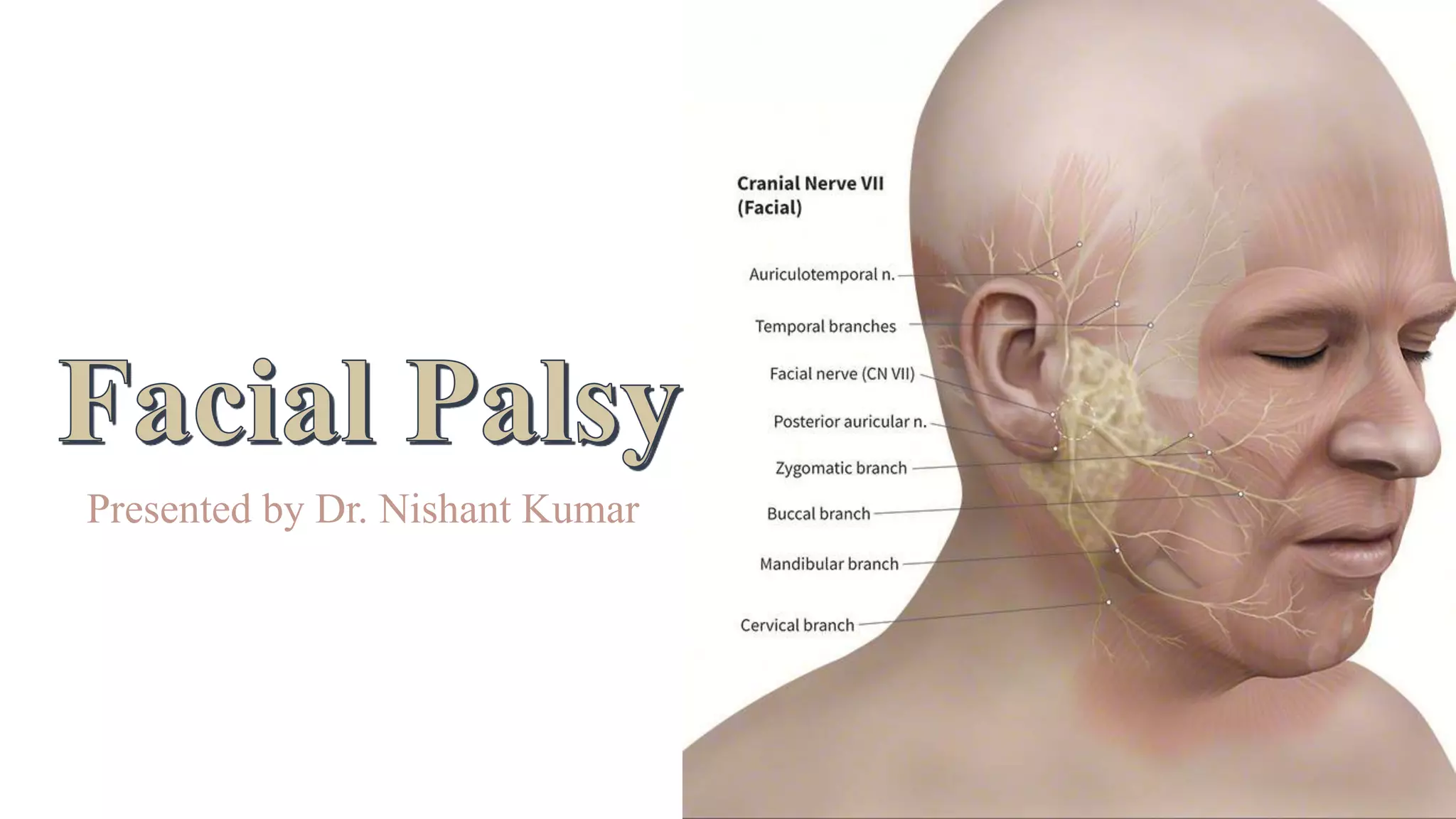 Fasial palsy | PPTX