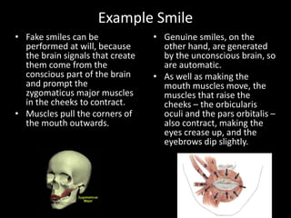 Structure Involved In Smiling Facial palsy- an update | PPTX