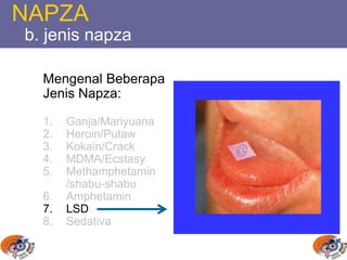 NAPZA
b. jenis napza
Mengenal Beberapa
Jenis Napza:
1. Ganja/Mariyuana
2. Heroin/Putaw
3. Kokain/Crack
4. MDMA/Ecstasy
5. Methamphetamin
/shabu-shabu
6. Amphetamin
7. LSD
8. Sedativa
 