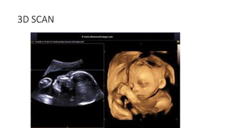 FAST ULTRASOUND SCAN PRESENTATION FOR BEGINNERS.pptx