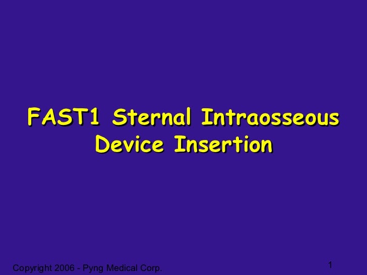 Fast1 training ppt 2006 - mil - compress