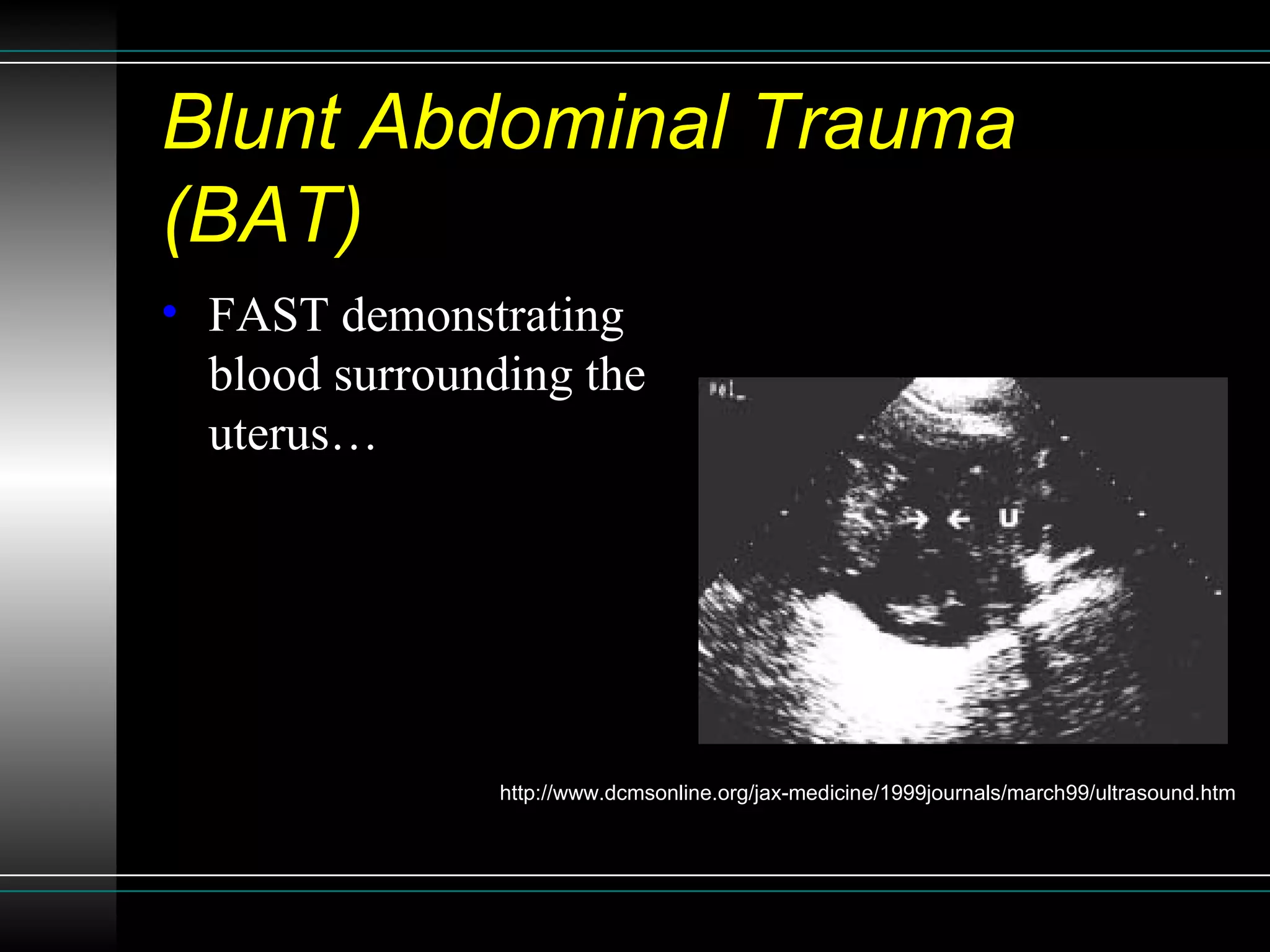 Sonographic Assessment of Blunt Abdominal Trauma in the Emergency ...