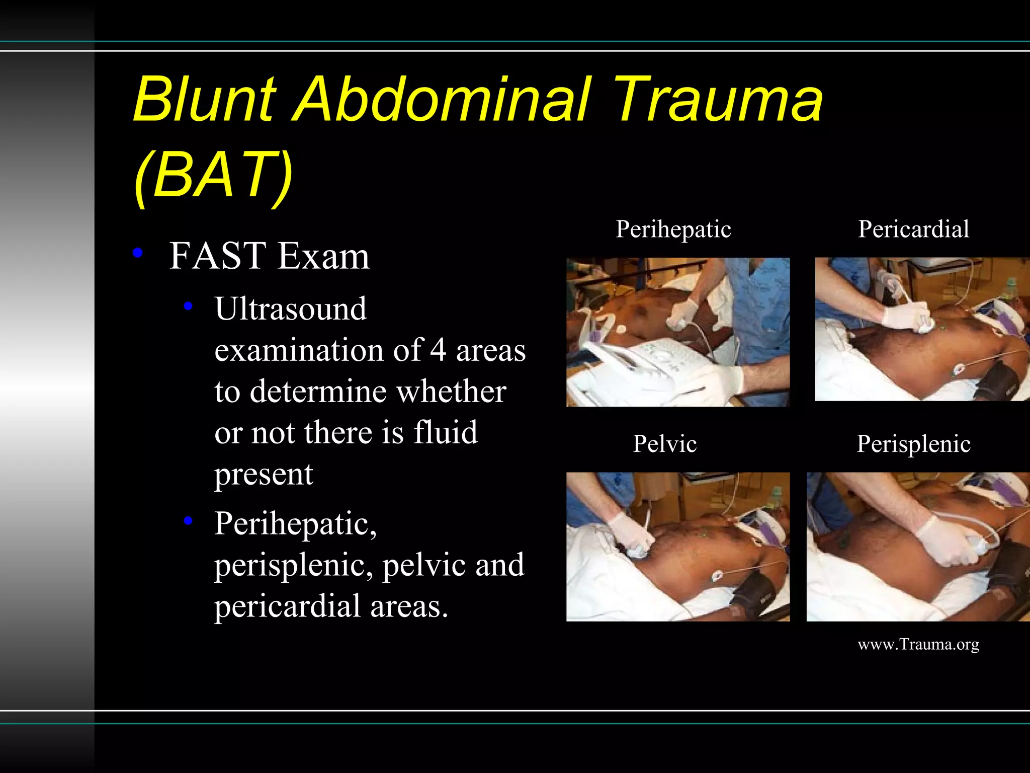 Sonographic Assessment of Blunt Abdominal Trauma in the Emergency ...