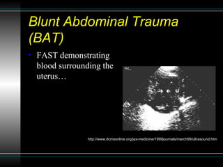 Blunt Abdominal Trauma (BAT) <ul><li>FAST demonstrating blood surrounding the uterus… </li></ul>http://www.dcmsonline.org/...