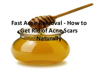 Fast Acne Removal - How to
Get Rid of Acne Scars
Naturally
 