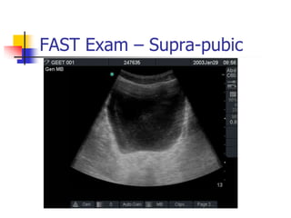 FAST Exam – Supra-pubic




       Transverse view
 