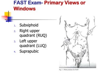 FAST Exam- Primary Views or
Windows


1.   Subxiphoid
2.   Right upper
     quadrant (RUQ)
3.   Left upper
     quadrant (LUQ)
4.   Suprapubic
 