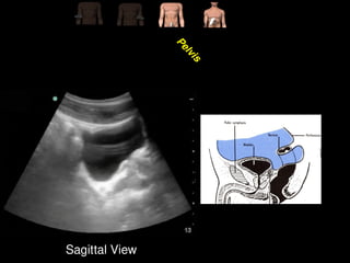 Comprehensive Guide to FAST & EFAST Ultrasound in Trauma Assessment | PPTX