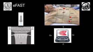 FAST EFAST TRAUMA DE ORGANOS CERRADOS.pptx