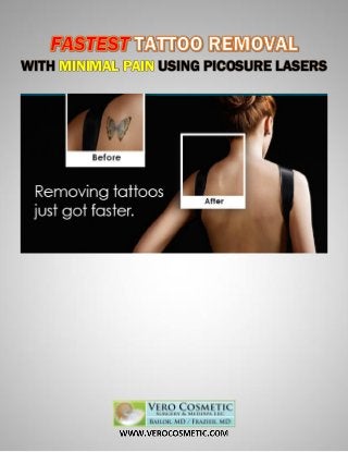 WITH MINIMAL PAIN USING PICOSURE LASERS
 