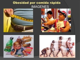 Obesidad por comida rápida
          IMAGENES
 