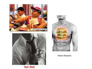 Heart diseases
 