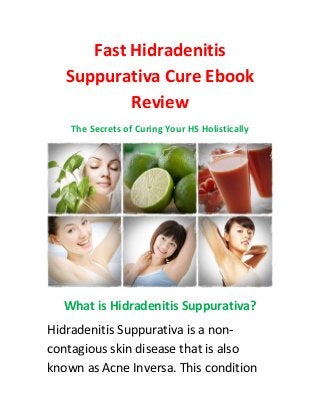 Fast Hidradenitis
Suppurativa Cure Ebook
Review
The Secrets of Curing Your HS Holistically
What is Hidradenitis Suppurativa?
Hidradenitis Suppurativa is a non-
contagious skin disease that is also
known as Acne Inversa. This condition
 