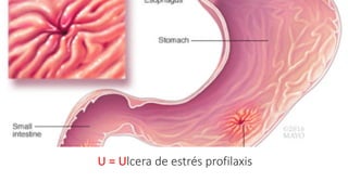 U = Ulcera de estrés profilaxis
 