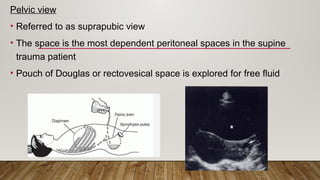 Fast scan presentation.pptx what is fast scan? | PPTX