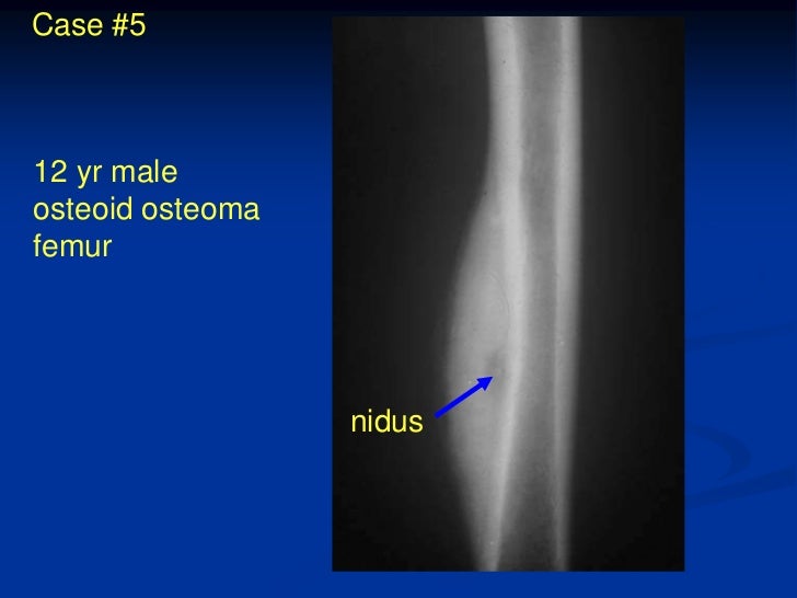 buy francois vallé and his world upper louisiana before lewis