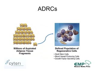 Fat Transfer with Adipose-derived Stem and Regenerative Cells for Breast Reconstruction