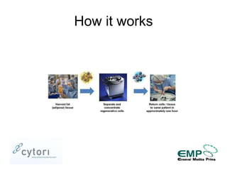 Fat Transfer with Adipose-derived Stem and Regenerative Cells for Breast Reconstruction