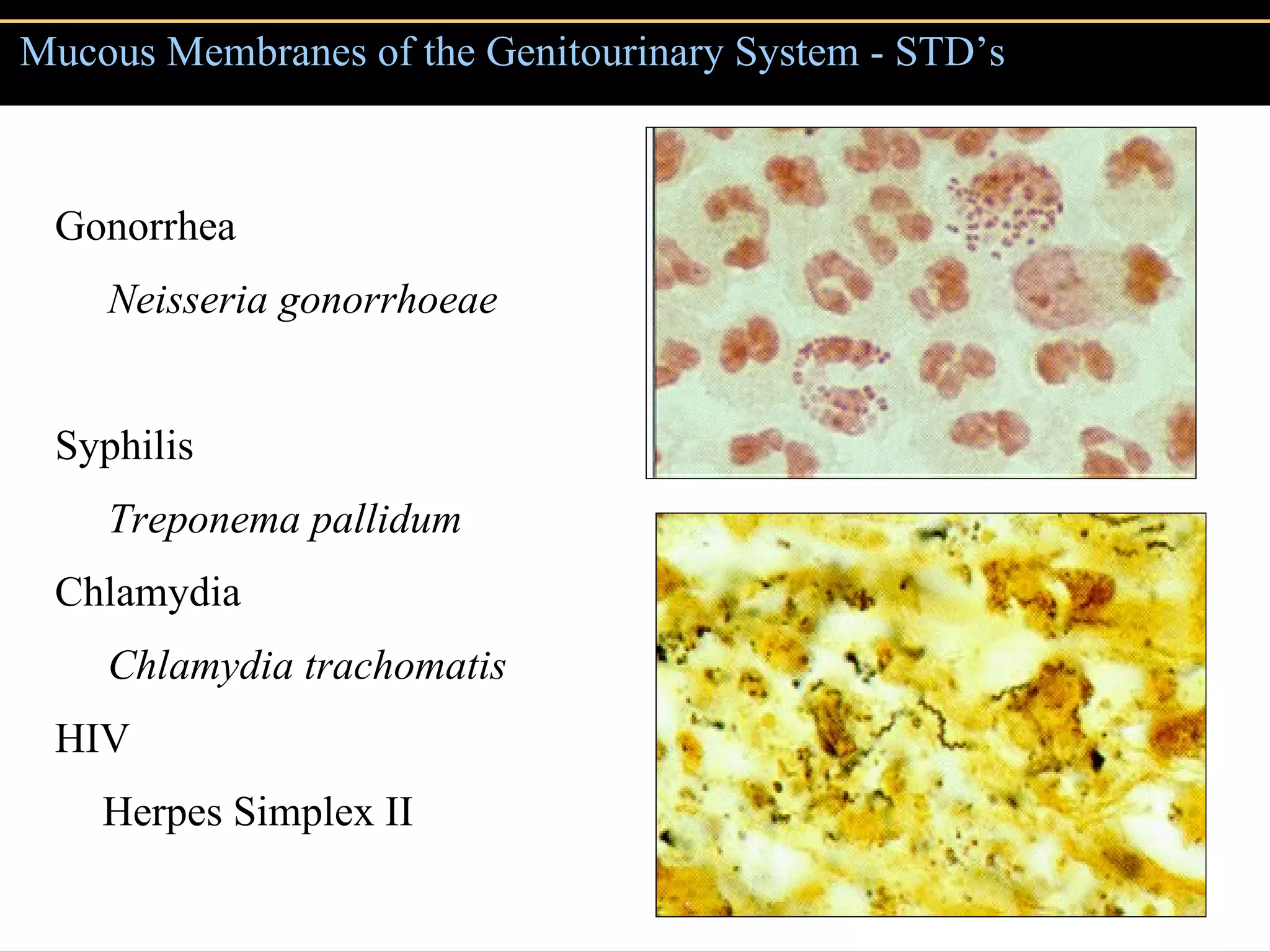 Mucous Membranes of the Genitourinary System - STD’s Gonorrhea Neisseria gonorrhoeae Syphilis Treponema pallidum Chlamydia Chlamydia trachomatis HIV Herpes Simplex II 
