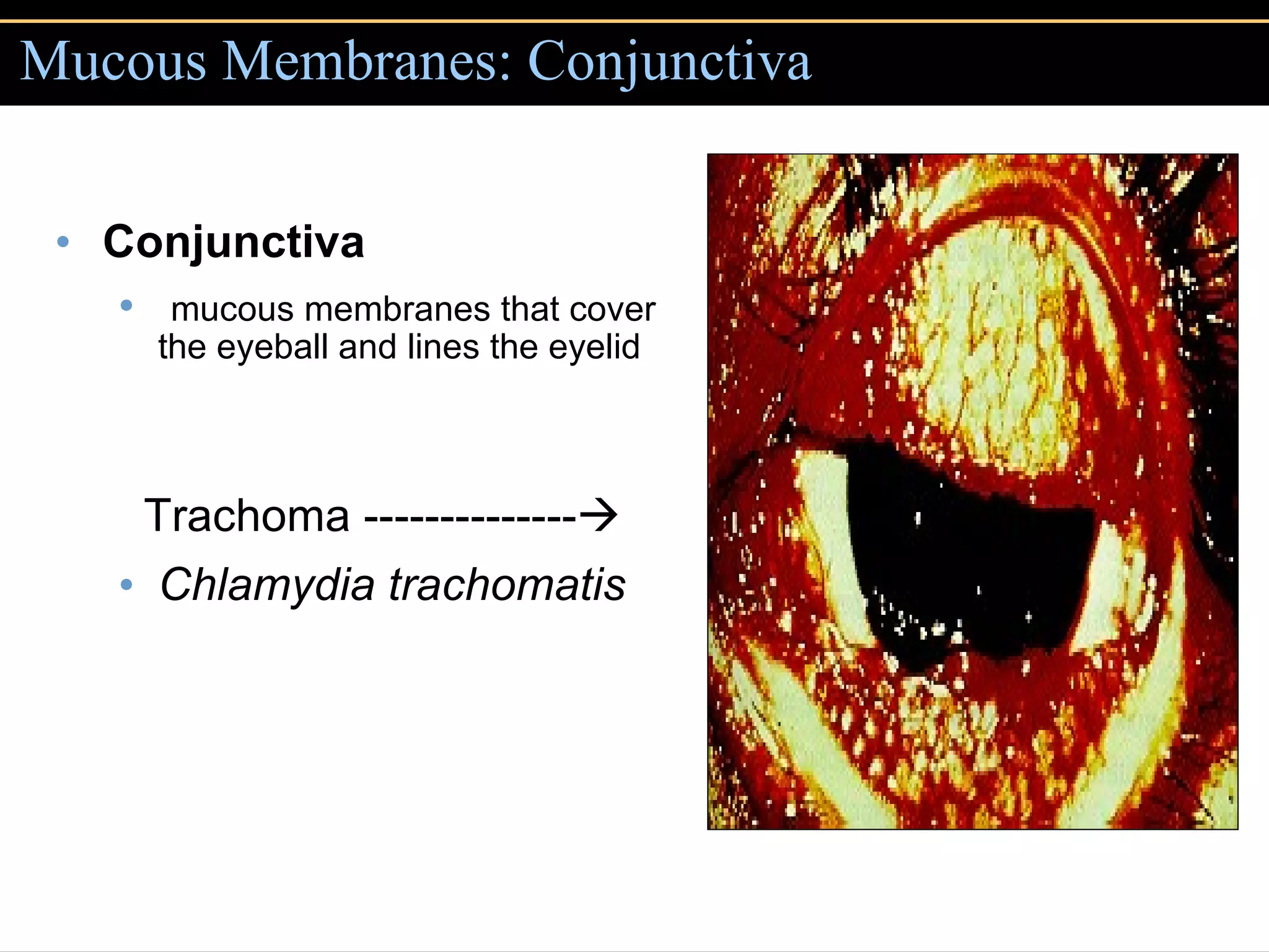Mucous Membranes: Conjunctiva Conjunctiva   mucous membranes that cover the eyeball and lines the eyelid Trachoma --------------  Chlamydia trachomatis 