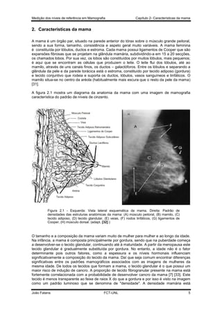 Medição dos níveis de referência em Mamografia

Capítulo 2- Características da mama

2. Características da mama
A mama é um órgão par, situado na parede anterior do tórax sobre o músculo grande peitoral,
sendo a sua forma, tamanho, consistência e aspeto geral muito variáveis. A mama feminina
é constituída por lóbulos, ductos e estroma. Cada mama possui ligamentos de Cooper que são
expansões fibrosas que se projetam na glândula mamária, subdividindo-a em 15 a 20 secções,
os chamados lobos. Por sua vez, os lobos são constituídos por muitos lóbulos, mais pequenos;
é aqui que se encontram as células que produzem o leite. O leite flui dos lóbulos, até ao
mamilo, através de uns canais finos, os ductos – galactóforos. Entre os lóbulos e separando a
glândula da pele e da parede torácica está o estroma, constituído por tecido adiposo (gordura)
e tecido conjuntivo que rodeia e suporta os ductos, lóbulos, vasos sanguíneos e linfáticos. O
mamilo situa-se no centro da aréola (habitualmente mais escura que o resto da pele da mama)
[31].
A figura 2.1 mostra um diagrama da anatomia da mama com uma imagem de mamografia
característica do padrão de níveis de cinzento.

Figura 2.1 - Esquerda: Vista lateral esquemática da mama. Direita: Padrão de
densidades das estruturas anatómicas da mama: (A) músculo peitoral, (B) mamilo, (C)
tecido adiposo, (D) tecido glandular, (E) veias, (F) nodos linfáticos, (G) ligamentos de
Cooper, (H) músculo dorsal. (adapt. [32] )

O tamanho e a composição da mama variam muito de mulher para mulher e ao longo da idade.
Na infância, a mama é composta principalmente por gordura, sendo que na puberdade começa
a desenvolver-se o tecido glandular, continuando até à maturidade. A partir da menopausa este
tecido glandular é gradualmente substituída por gordura. No entanto, a idade não é o fator
determinante pois outros fatores, como a espessura e os níveis hormonais influenciam
significativamente a composição do tecido da mama. Daí que seja comum encontrar diferenças
significativas entre os padrões mamográficos associados com as imagens de mulheres da
mesma idade. De todos os tecidos que formam a mama, o tecido glandular é o que possui um
maior risco de indução de cancro. A proporção de tecido fibrogranular presente na mama está
fortemente correlacionada com a probabilidade de desenvolver cancro da mama [7] [33]. Este
tecido é menos transparente ao feixe de raios X do que a gordura e por isso é visto na imagem
como um padrão luminoso que se denomina de "densidade". A densidade mamária está
João Fatana

FCT-UNL

5

 