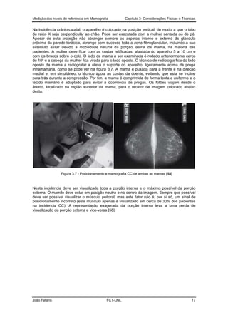 Medição dos níveis de referência em Mamografia

Capítulo 3- Considerações Físicas e Técnicas

Na incidência crânio-caudal, o aparelho é colocado na posição vertical, de modo a que o tubo
de raios X seja perpendicular ao chão. Pode ser executada com a mulher sentada ou de pé.
Apesar de esta projeção não abranger sempre os aspetos interno e externo da glândula
próxima da parede torácica, abrange com sucesso toda a zona fibroglandular, incluindo a sua
extensão axilar devido à mobilidade natural da porção lateral da mama, na maioria das
pacientes. A mulher deve ficar com as costas retificadas, afastada do aparelho 5 a 10 cm e
com os braços sobre o colo. O lado da mama a ser examinada é rodado anteriormente cerca
de 10º e a cabeça da mulher fica virada para o lado oposto. O técnico de radiologia fica do lado
oposto da mama a radiografar e eleva o suporte do aparelho, ligeiramente acima da prega
inframamária, como se pode ver na figura 3.7. A mama é puxada para a frente e na direção
medial e, em simultâneo, o técnico apoia as costas da doente, evitando que esta se incline
para trás durante a compressão. Por fim, a mama é comprimida de forma lenta e uniforme e o
tecido mamário é adaptado para evitar a ocorrência de pregas. Os fotões viajam desde o
ânodo, localizado na região superior da mama, para o recetor de imagem colocado abaixo
desta.

Figura 3.7 - Posicionamento e mamografia CC de ambas as mamas [58]

Nesta incidência deve ser visualizada toda a porção interna e o máximo possível da porção
externa. O mamilo deve estar em posição neutra e no centro da imagem. Sempre que possível
deve ser possível visualizar o músculo peitoral, mas este fator não é, por si só, um sinal de
posicionamento incorreto (este músculo apenas é visualizado em cerca de 30% dos pacientes
na incidência CC). A representação exagerada da porção interna leva a uma perda de
visualização da porção externa e vice-versa [58].

João Fatana

FCT-UNL

17

 