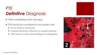 PTE
Definitive Diagnosis
 Often established after necropsy.
 PTE should be considered in any patient with
 Acute onset of tachypnea
 Labored breathing refractory to oxygene therapy
 with normal or near-normal findings on radiography.
Dr.Hadi ALİHOSSEİNİ
 