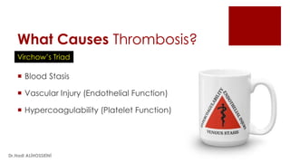 What Causes Thrombosis?
 Blood Stasis
 Vascular Injury (Endothelial Function)
 Hypercoagulability (Platelet Function)
Virchow’s Triad
Dr.Hadi ALİHOSSEİNİ
 