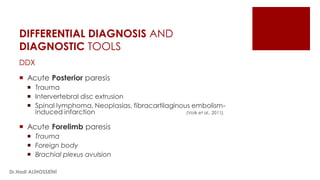 DIFFERENTIAL DIAGNOSIS AND
DIAGNOSTIC TOOLS
DDX
 Acute Posterior paresis
 Trauma
 Intervertebral disc extrusion
 Spinal lymphoma, Neoplasias, fibracartilaginous embolism-
induced infarction (Volk et al., 2011).
 Acute Forelimb paresis
 Trauma
 Foreign body
 Brachial plexus avulsion
Dr.Hadi ALİHOSSEİNİ
 