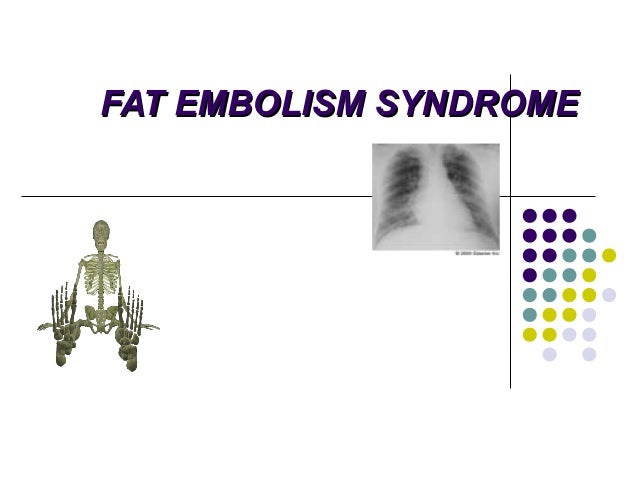 Fat embolism