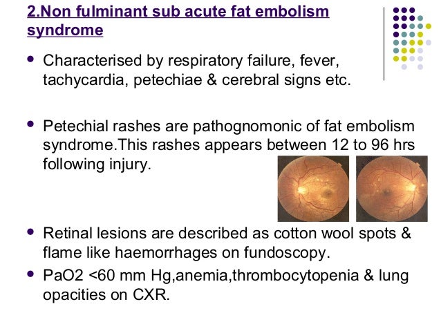 Fat embolism