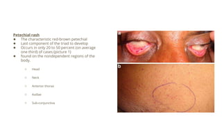 Petechial rash
● The characteristic red-brown petechial
● Last component of the triad to develop
● Occurs in only 20 to 50 percent (on average
one third) of cases (picture 1)
● found on the nondependent regions of the
body.
○ Head
○ Neck
○ Anterior thorax
○ Axillae
○ Sub-conjunctiva
 