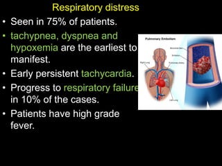 Respiratory distress
• Seen in 75% of patients.
• tachypnea, dyspnea and
hypoxemia are the earliest to
manifest.
• Early persistent tachycardia.
• Progress to respiratory failure
in 10% of the cases.
• Patients have high grade
fever.
 