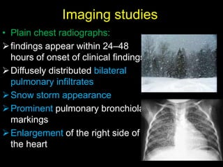 Imaging studies
• Plain chest radiographs:
findings appear within 24–48
hours of onset of clinical findings-
Diffusely distributed bilateral
pulmonary infiltrates
Snow storm appearance
Prominent pulmonary bronchiolar
markings
Enlargement of the right side of
the heart
 
